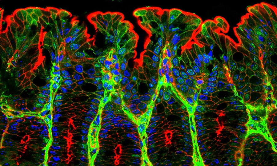 美国Lumencor多通道光源助力生物学领域的研究_美国Lumencor多通道光源助力生物学领域的研究_