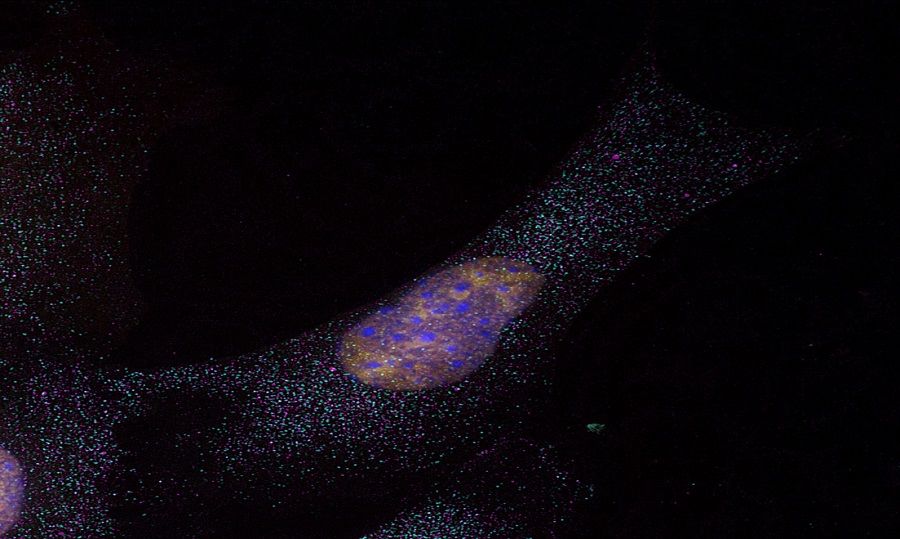 美国Lumencor多通道光源助力生物学领域的研究__美国Lumencor多通道光源助力生物学领域的研究